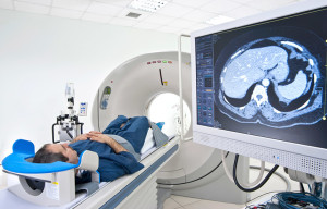 Лечение олигодендроглиальной опухоли мозга в Израиле в клинике Ассута