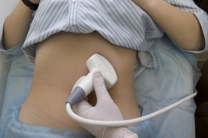 Лечение неопластической кисты поджелудочной железы в Израиле в Ассуте